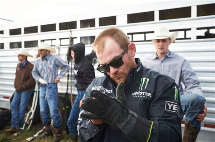 Chase Outlaw broke almost every bone in his face. Doctors put it back