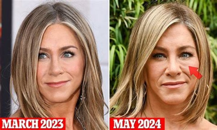 Has Jennifer Aniston Had Cosmetic Surgery?