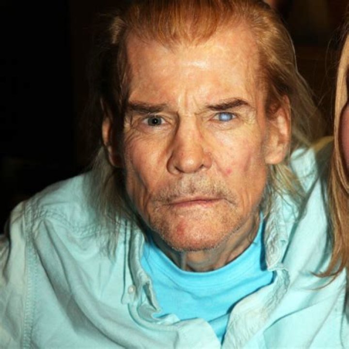 How did Jan Michael Vincent fare? How Did He Amputate His Leg?