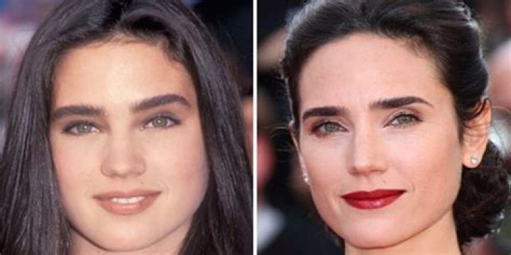 Jennifer Connelly Breast Reduction