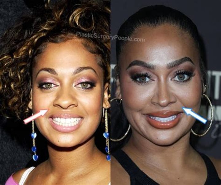 Lala Anthony, BEFORE and AFTER 2022