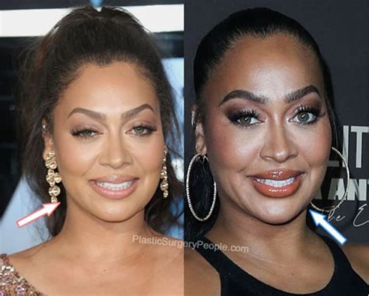 Lala Anthony Plastic Surgery Boobs (Boob Job), Nose Job and Botox