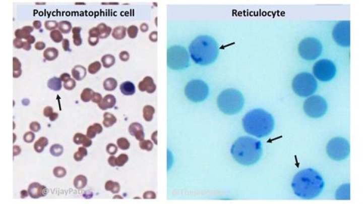 Reticulocyte Stain