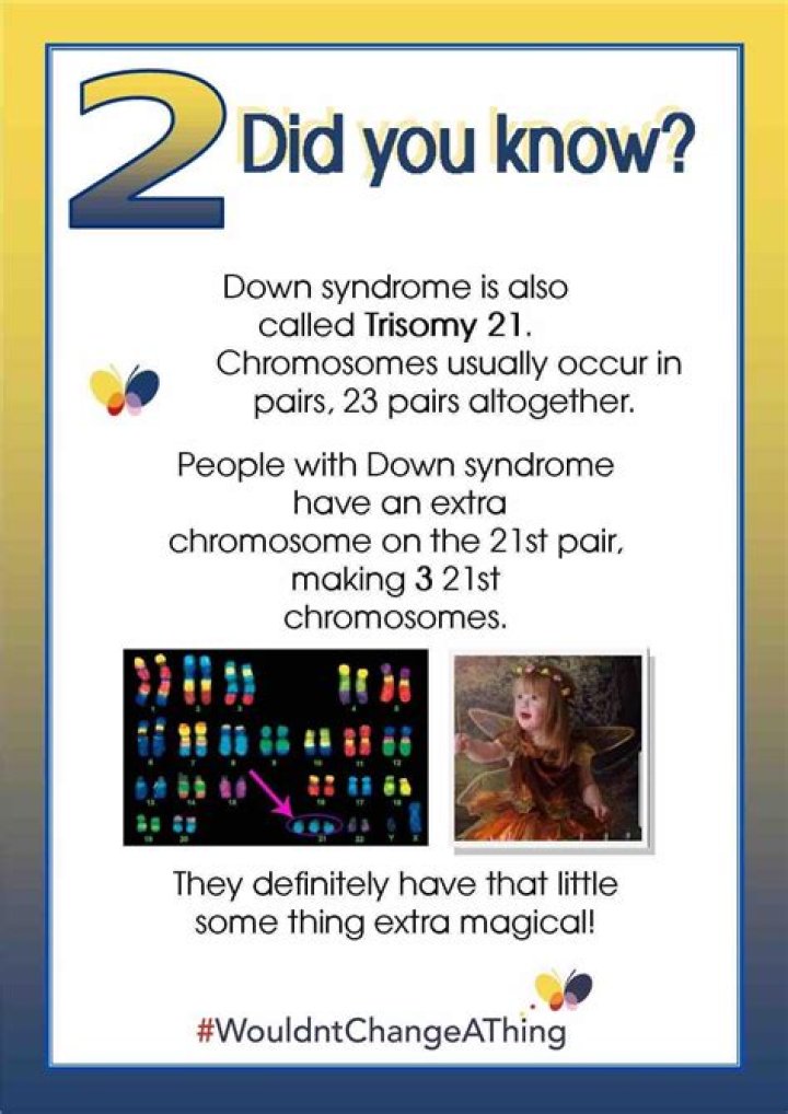 Things to Know About Down Syndrome Physical Traits Carrie with Children